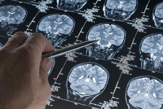 Hope, accuracy, healing: Advances in brain tumor care