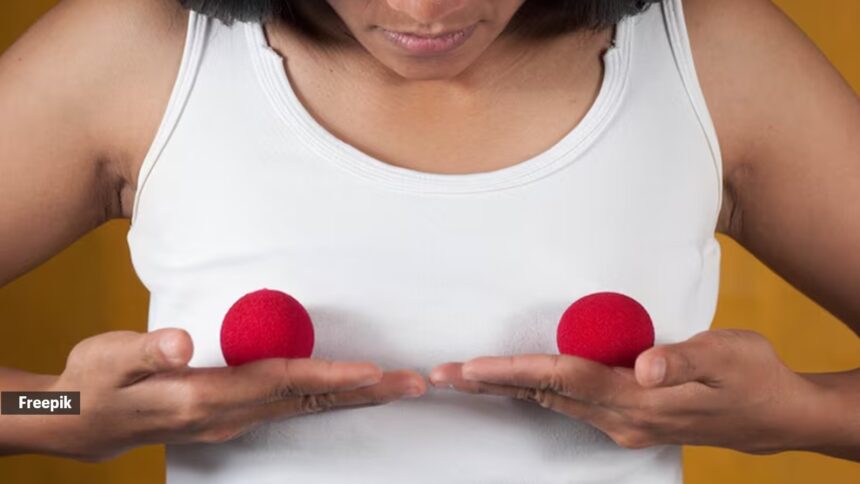 Jogger’s nipple is a form of friction-induced irritation