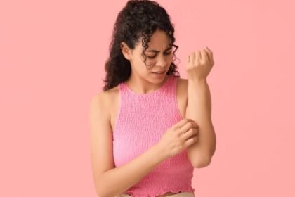 Cucumber to coriander: 10 home medications for fever rashes to soothe the skin