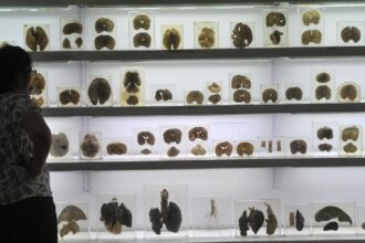 World Brain Health Day: Stroke management and head trauma care provided by Karnataka's "hub and spoke" model