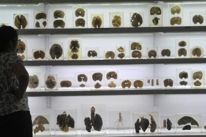 World Brain Health Day: Stroke management and head trauma care provided by Karnataka's "hub and spoke" model