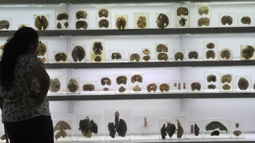 World Brain Health Day: Stroke management and head trauma care provided by Karnataka's "hub and spoke" model