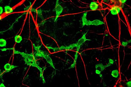 Immune Cell Fat Blocks the Brain's Ability to Clean Alzheimer's Disease Plaque