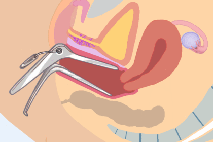 Researchers redesign the speculum to relieve fear and pain
