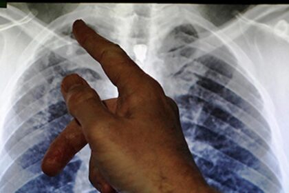 44 TB's death at Mizoram this year: official