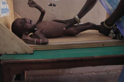 A complex web of factors behind India's persistent stunting crisis