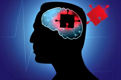 Fake therapy: When depression impersonates dementia