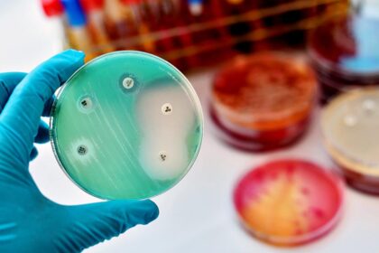 IIT Madras is developing low-cost, chip-based devices to speed up antibiotic susceptibility testing