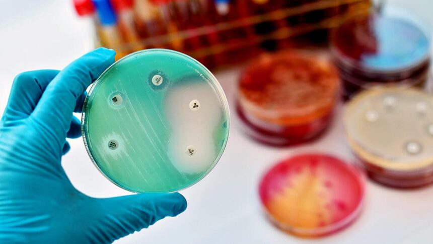 IIT Madras is developing low-cost, chip-based devices to speed up antibiotic susceptibility testing