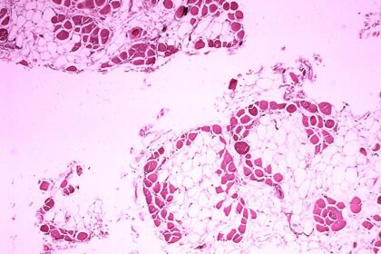 Short of Hope: Indian Rare Disease Patients struggling without sustainable drug access