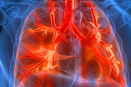 Premigen strains jump after our FDA approved the first therapy for rare respiratory diseases