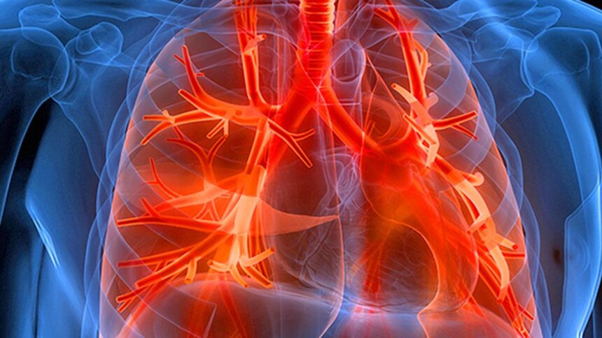 Premigen strains jump after our FDA approved the first therapy for rare respiratory diseases