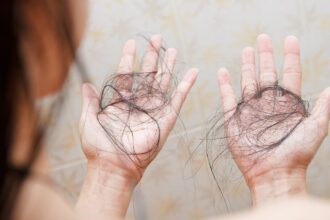 International Alopecia 2025: Cosmetic Surgeons explain why autoimmune hair loss is on the rise