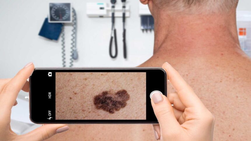 Is your skin app misleading you? Why is it necessary to see a dermatologist?