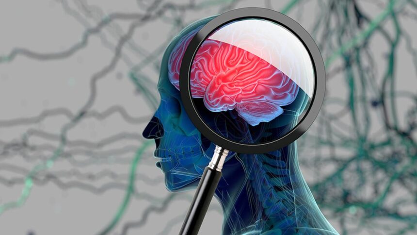 Alzheimer's disease is not "old age": Early diagnosis is essential for treatment and management