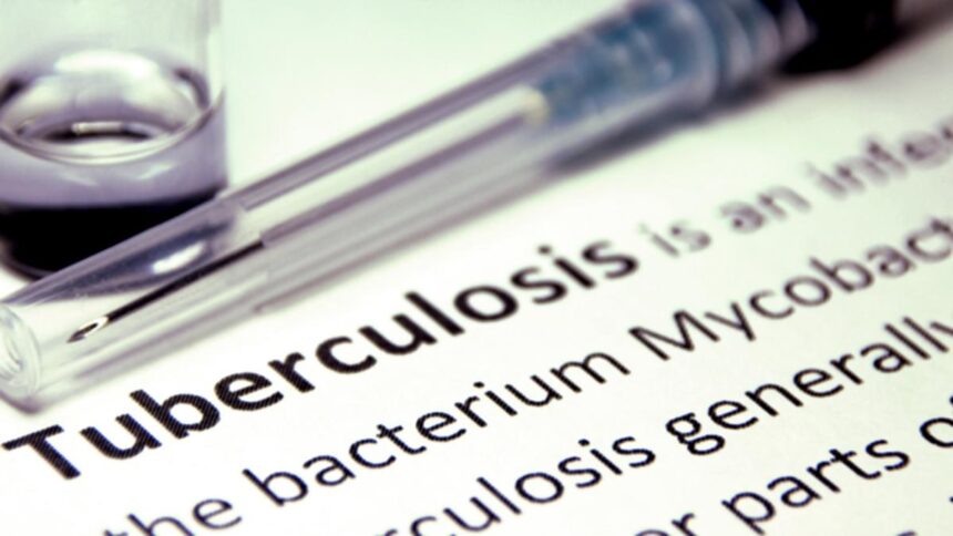 Global Health Group prioritizes the poorest of aid reductions