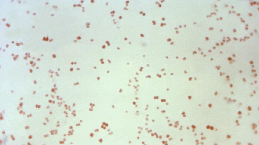 Sexually transmitted disease cases decrease, but not neonatal syphilis