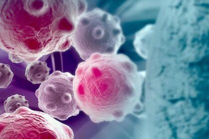 Study finds obesity-related cancer cases are on the rise in both young and old people