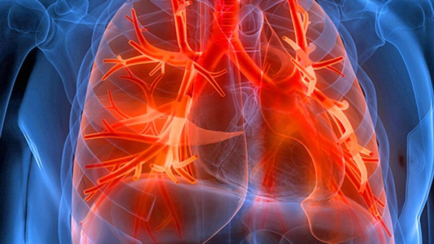 Improving living conditions and sustainable policies could reduce the burden of lung disease, experts say