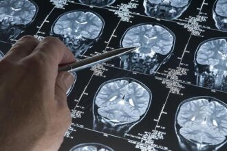 There is an urgent need to make stroke rehabilitation mainstream.