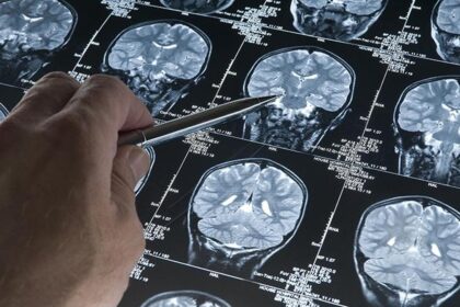 There is an urgent need to make stroke rehabilitation mainstream.