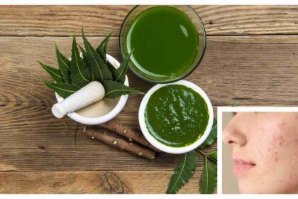 How to use neem to reduce acne and acne without destroying your skin