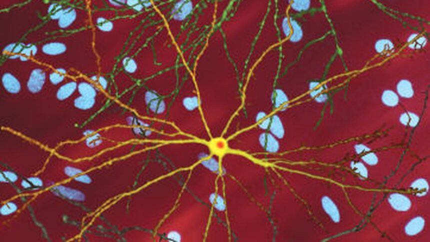 Researchers and families confront Huntington's disease with rhythm and determination