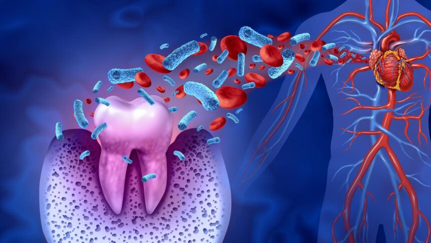 Can hidden dental bacteria help explain a sudden, fatal heart attack?