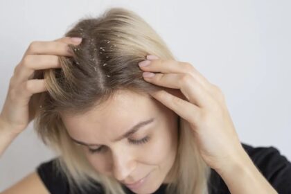 Tired of greasy, sticky dandruff? Here are 6 easy fixes you need