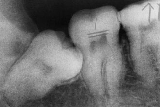 Why do humans have baby teeth and adult teeth?