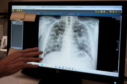Webinar investigating air quality and its impact on lung health will be held on November 23