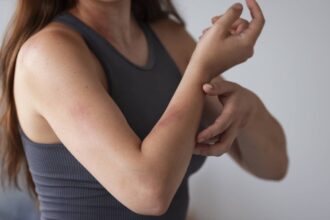 How can colloidal oatmeal and ceramides help overcome eczema? A dermatologist has the answer