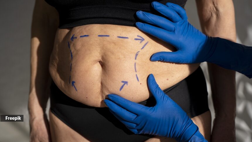 The hidden brain risk after bariatric surgery most people don’t know about