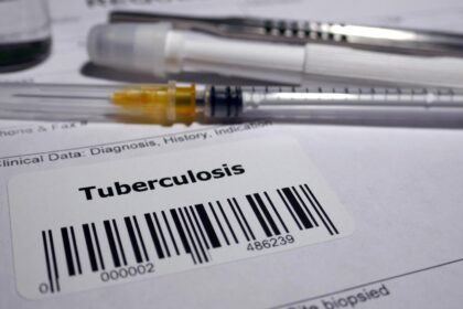 New tuberculosis vaccine for adolescents and adults ready for commercialization