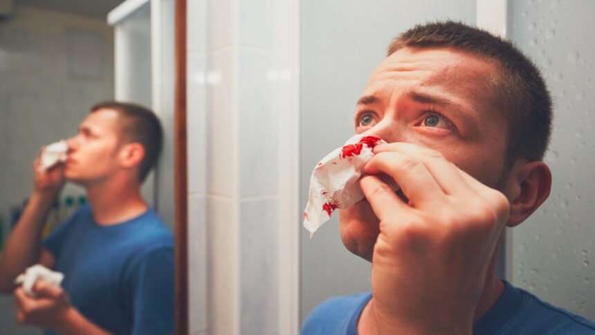 nose bleed