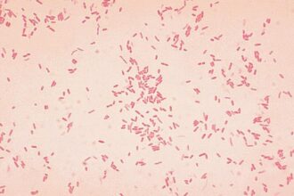 Microbes may cause early stages of ulcerative colitis: new study