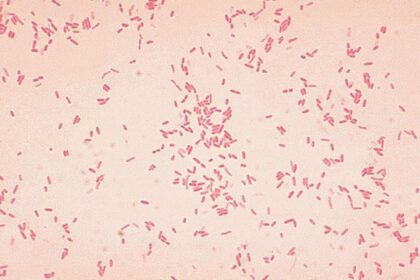 Microbes may cause early stages of ulcerative colitis: new study