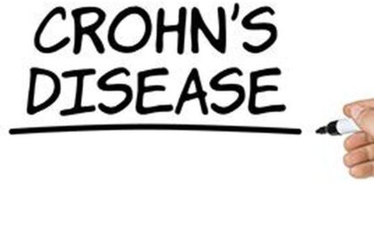 What you need to know: About Crohn's disease