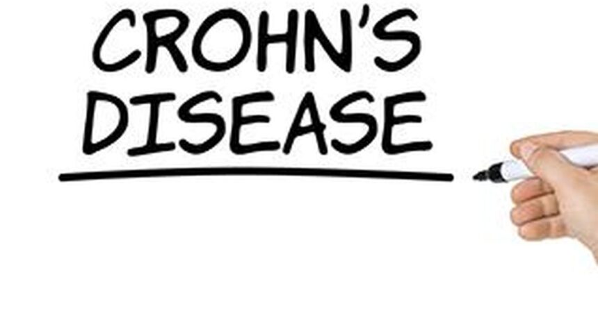 What you need to know: About Crohn's disease