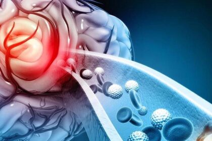 Domestic stroke device approved based on domestic clinical trial data, scheduled to be released in February 2026