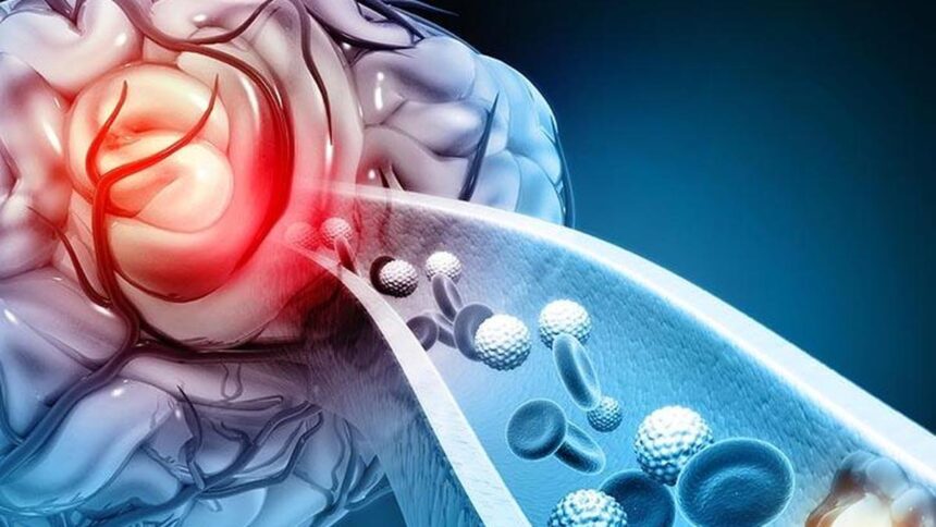Domestic stroke device approved based on domestic clinical trial data, scheduled to be released in February 2026