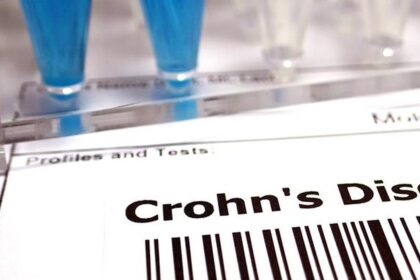 The reality of invisible diseases and the challenges of Crohn's disease treatment in India