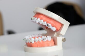 Why do we have wisdom teeth?