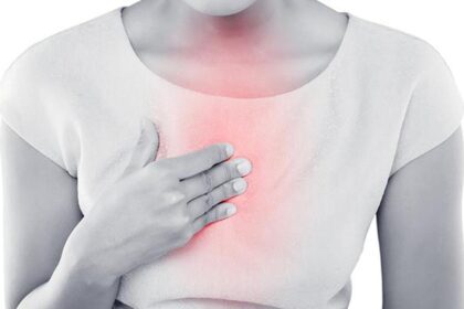 Understanding, managing, and preventing burns