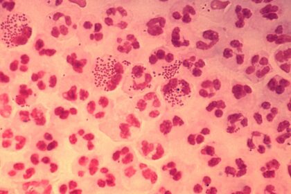 What you need to know: About gonorrhea