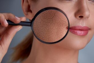 Winter skincare tips: Dermat says to avoid long hot showers and apply thicker creams.