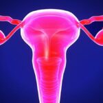What women need to know about pelvic inflammatory disease