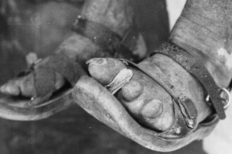 The story of dapsone: from dye to drug