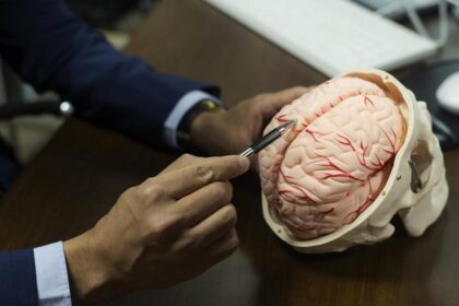 Do changes in white matter in the brain determine our aging trajectory?