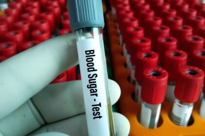 Anemia and blood disorders can skew HbA1c results from diabetes tests, study says